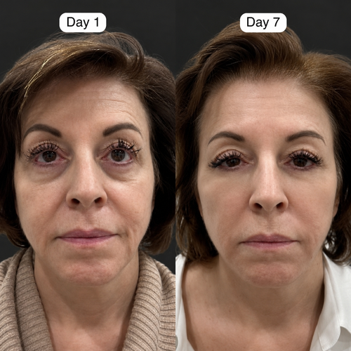 Sculpting and Lymphatic Drainage Brush